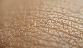 a close up image of skin were a few tiny hairs are visible